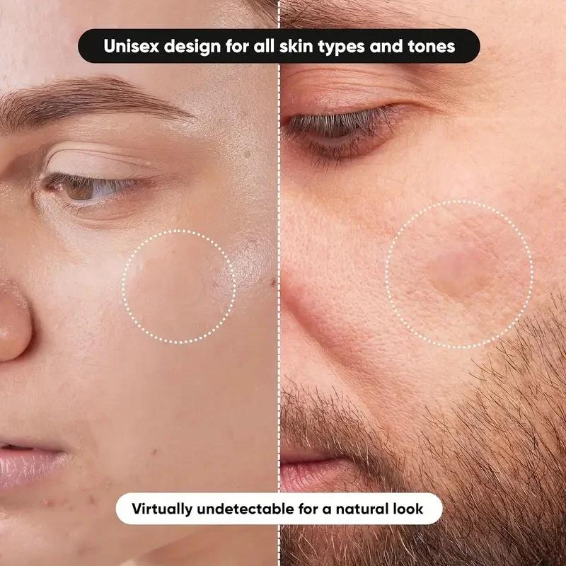 360 pieces/box acne patches -  - огляд і ціна Face Moisturizer
