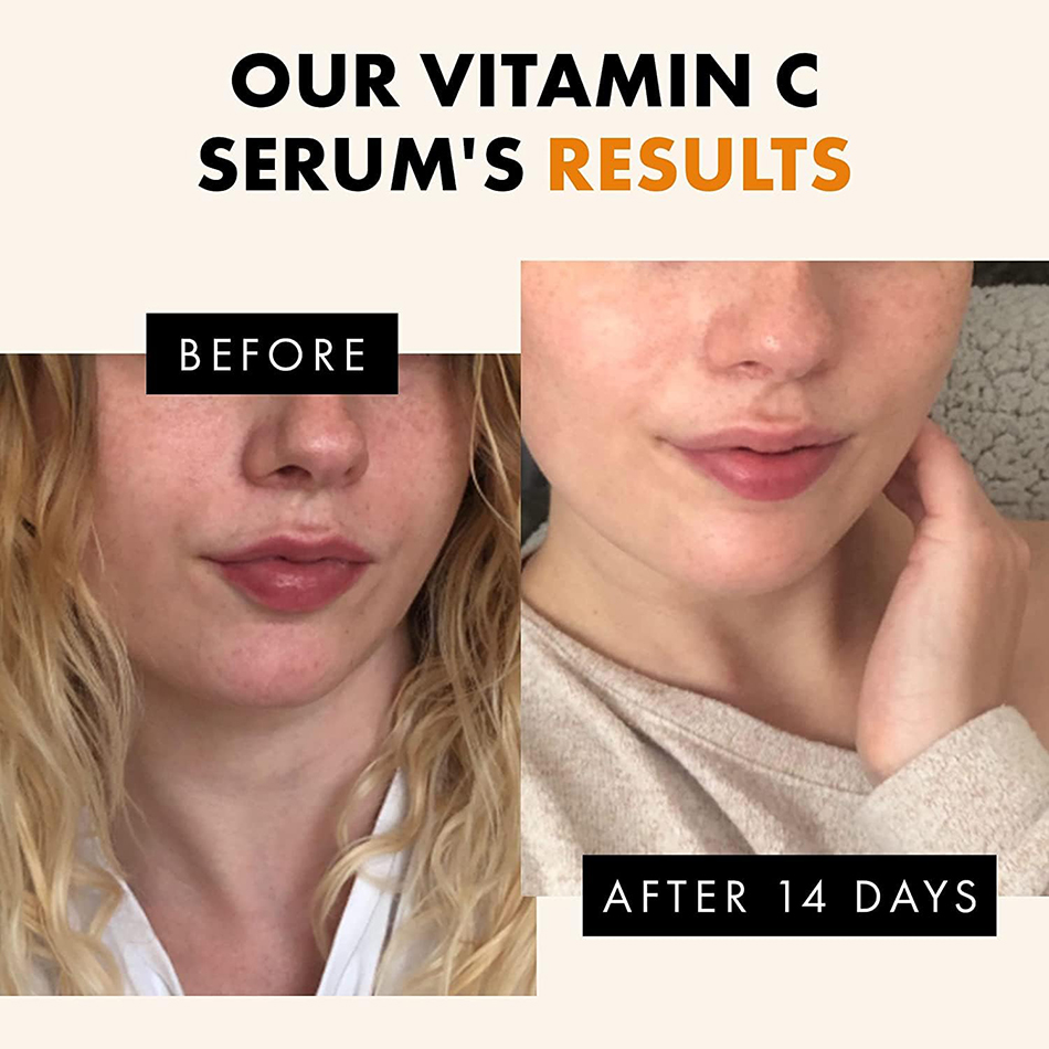 Super 120ml Vitamin C Serum An - огляд і ціна Vitamin C Serum